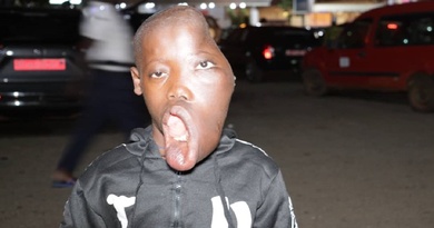 Humanitaire: malade d’une tumeur, Abdoulaye keita bénéficie d’une évacuation à Paris Humanitaire: malade d’une tumeur, Abdoulaye keita bénéficie d’une évacuation à Paris