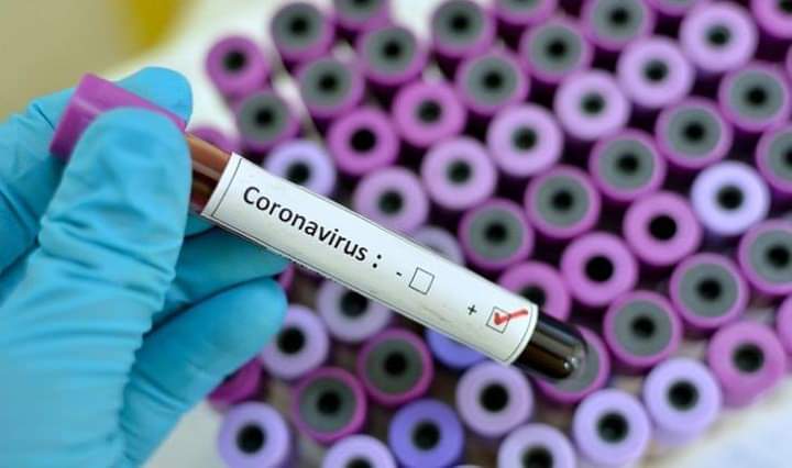 Coronavirus-Covid-19